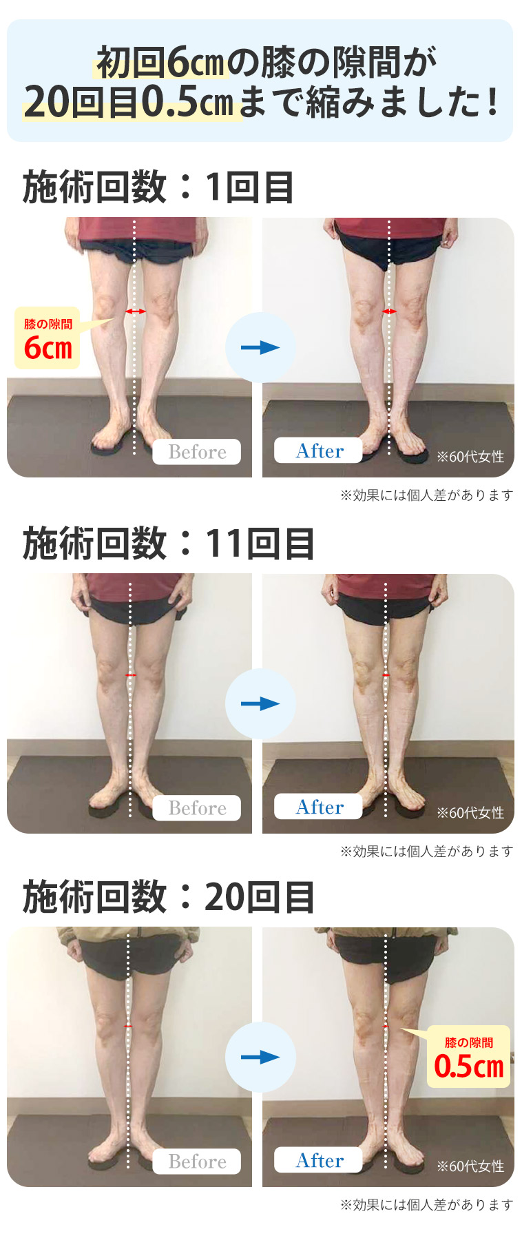 ビフォーアフター