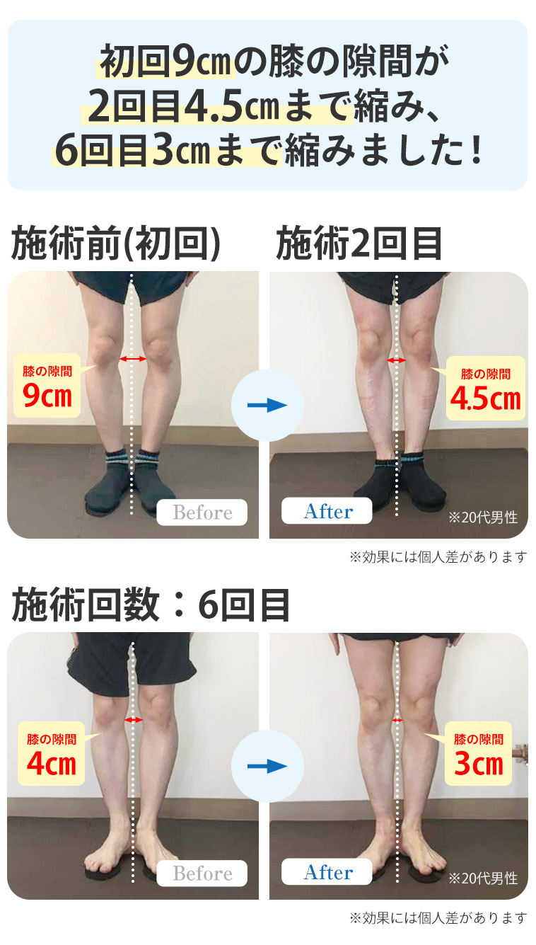 ビフォーアフター