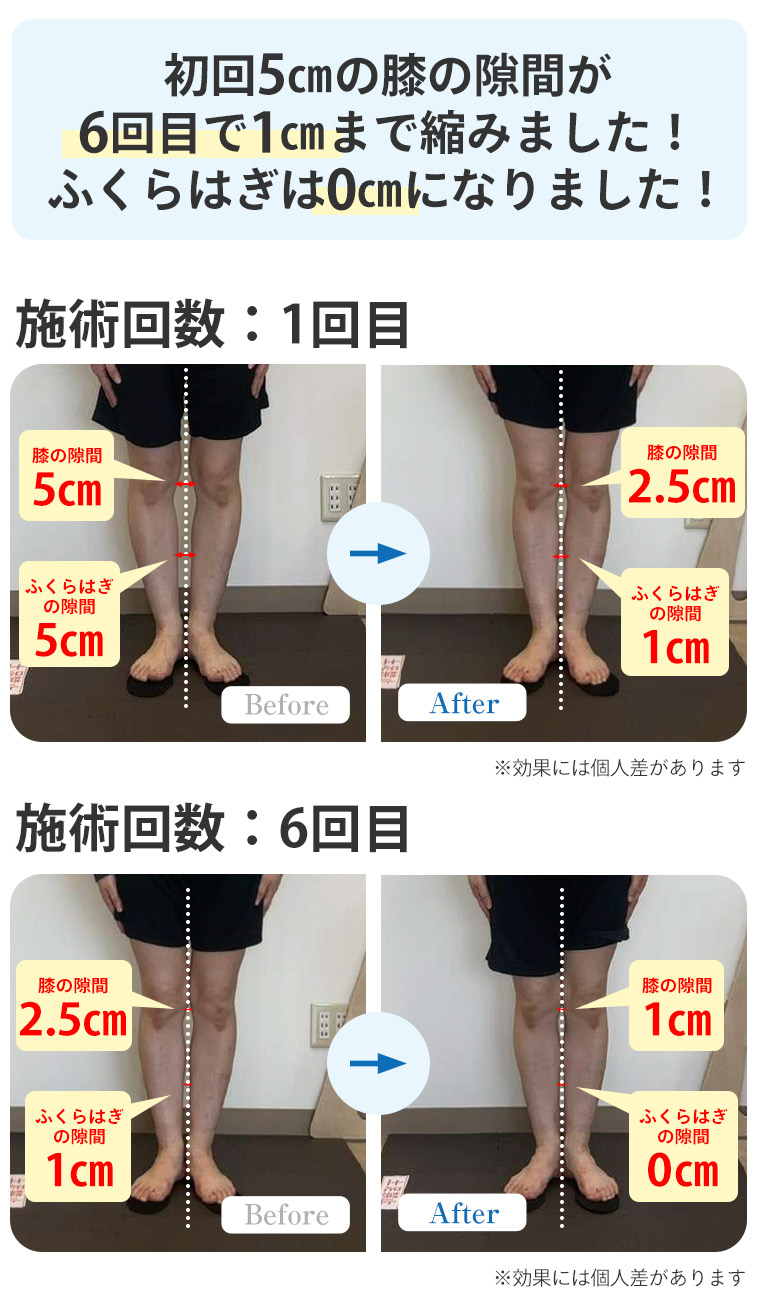 ビフォーアフター