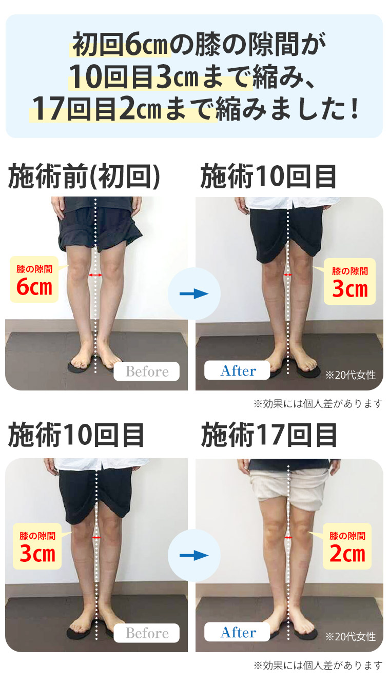 ビフォーアフター